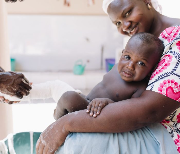 Ibrahim, clubfoot patient, having one of his casts removed during an appointment at Ponseti.