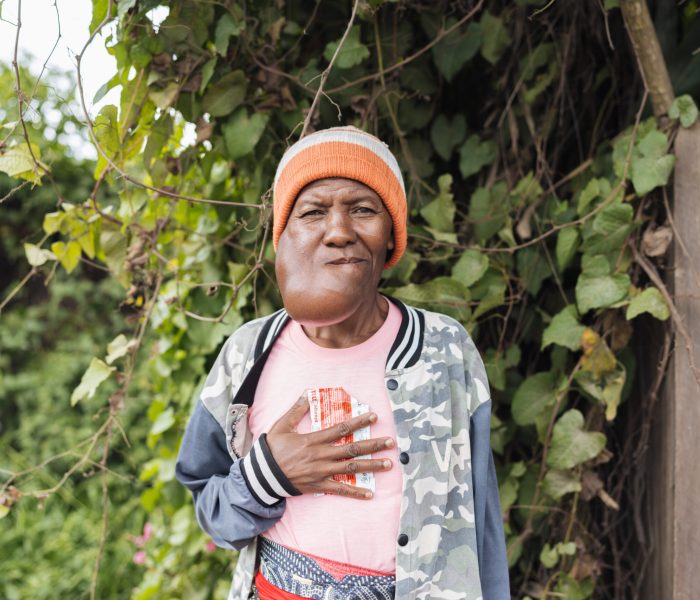 Marie Elise, maxillofacial patient.