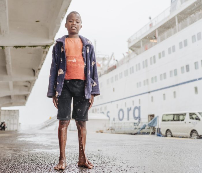 Tera, plastics patient.