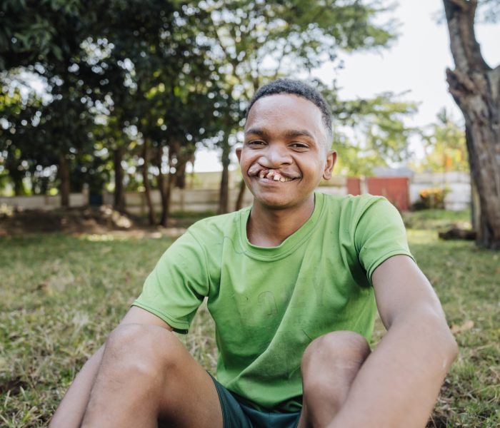 Joseph, cleft lip patient.