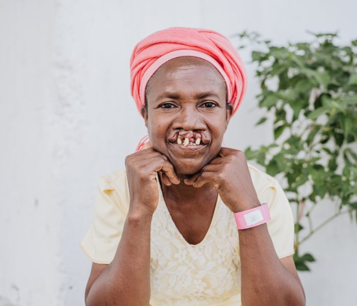 Lusette, maxillofacial patient.