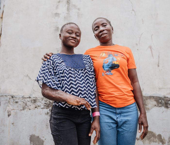 Naserry, plastics patient, with her aunt.