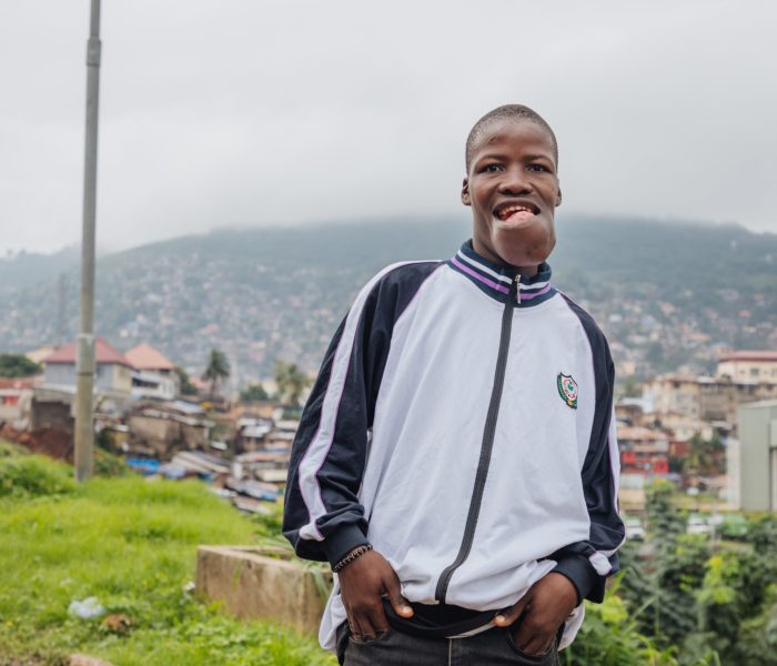 Alex, maxillofacial patient, the morning of his hospital admission.