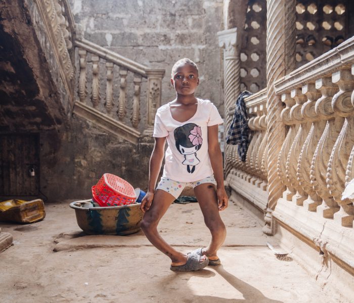 Fudia, orthopedics patient, during a home visit.