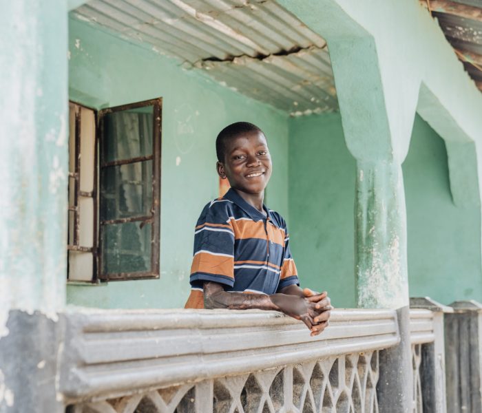 Yusif, plastics patient.