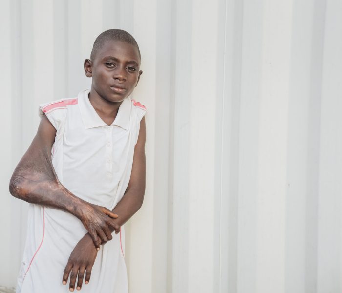 David, plastics patient.