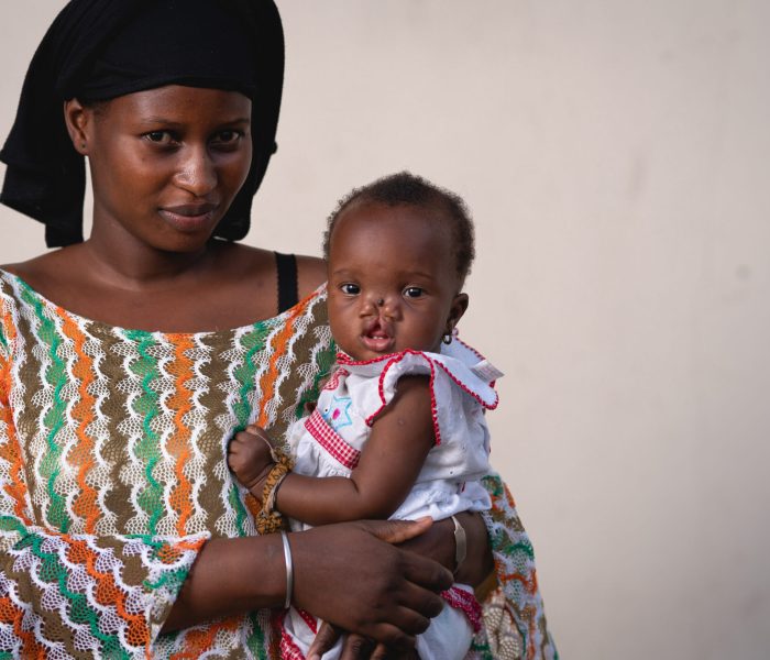 Mariama, maxillofacial patient, with her mother before surgery.