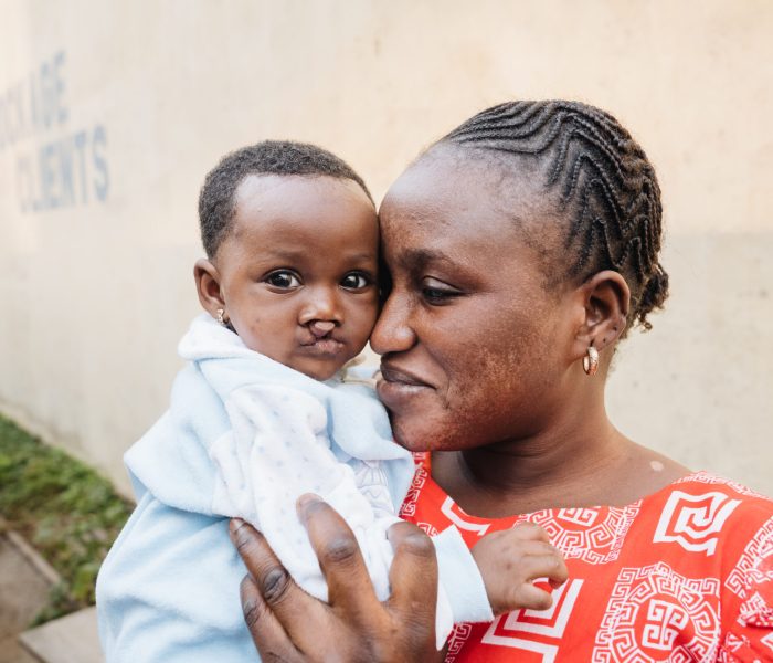 Mame Diarra, cleft lip patient, on the dock during admission with her mother Ndiate.