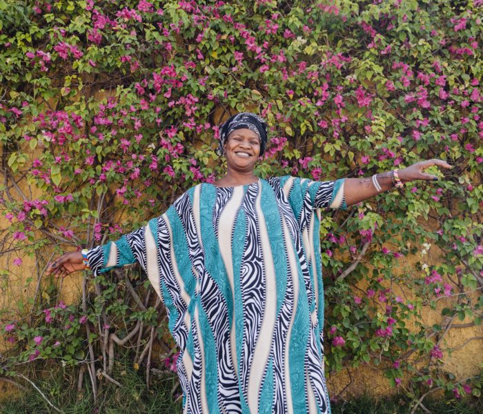 Lolly, plastics patient.